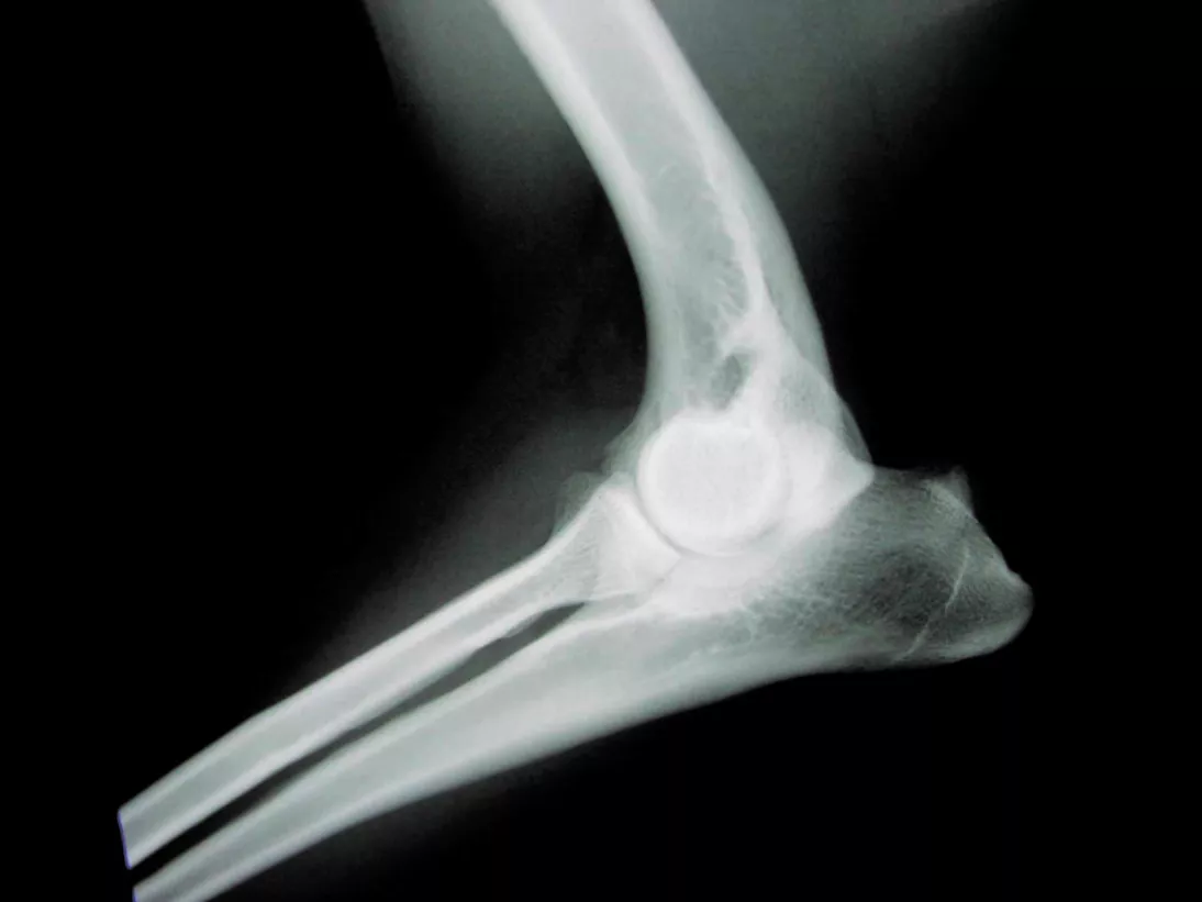 3M™ Ultra Detail Plus Veterinary X-ray Film (Green sensitive), 8